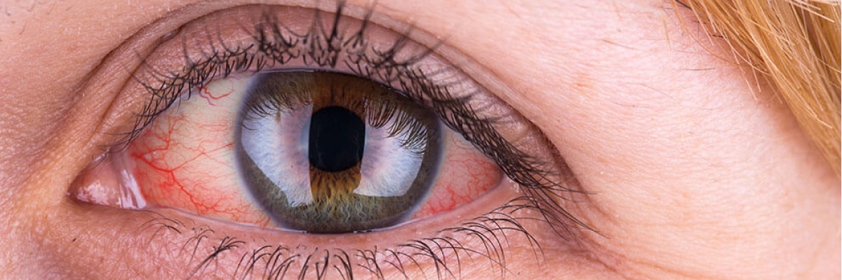 Sinsice ilerliyor: 2040 yılına kadar 111 milyondan fazla kişiyi etkileyebilir